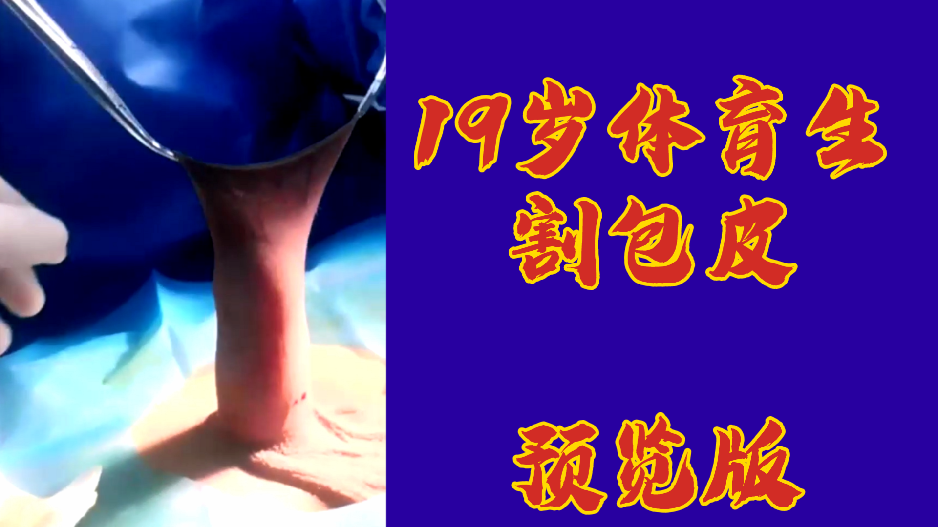19歲體育生割包皮，預覽版